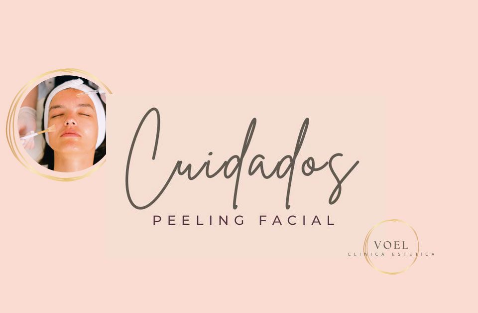 Peeling facial - VOEL - 023 - Cuidados