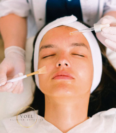 Peeling facial - VOEL